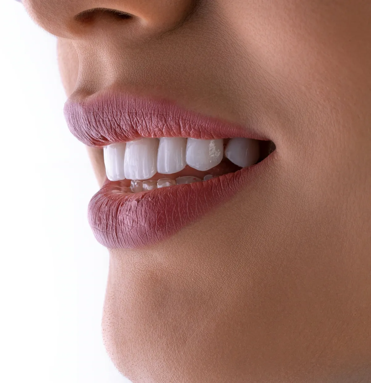 Sorriso com dentes brancos e alinhados